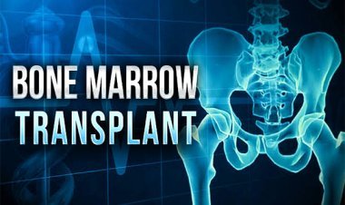 बोन मैरो प्रत्यारोपण कार्यशाला 25 मार्च को रतलाम में, थैलेसीमिया व सिकल सेल के 55 बच्चों व 120 परिजन की निःशुल्क एचएलए जांच होगी