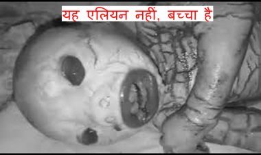 यह एलियन नहीं बच्चा है : मप्र के रतलाम में जन्मा अजीबो-गरीब बच्चा, डॉक्टर ने कहा- जेनेटिक समस्या के कारण जन्मा कोलोडियन बेबी, देखें वीडियो...