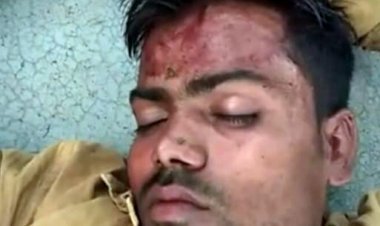 खूनी संघर्ष : पहले खेत से आम उठाने से रोका, फिर बोल दिया कुल्हाड़ी और लाठी से हमला, महिलाओं से मारपीट का भी आरोप