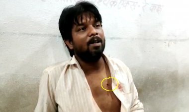 अमृत सागर तालाब की पाल पर बैठकर पी रहे थे सिगरेट, तभी सीने में छर्रा लगने से 25 वर्षीय युवक हो गया घायल, केस दर्ज