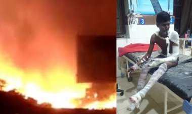 ये है हादसे का डिपो : बॉयो डीजल डिपो में आग लगने से 3 कर्मचारी झुलसे, 2 इंदौर रैफर, पक्ष जानना चाहा तो चेयरमैन ने मैसेज कर कहा- हमारा ध्यान रखना