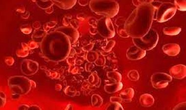 एडवाइजरी : सिकलसेल एनीमिया से पीड़ित बच्चों का विशेष ध्यान रखें, इस बीमारी से ग्रसित महिला और पुरुष आपस में न करें शादी