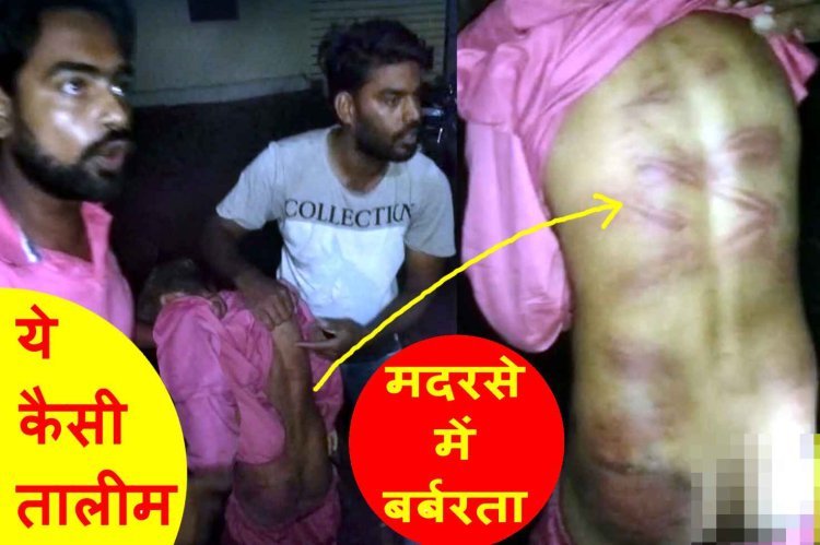 मदरसे में बर्बरता : सबक याद नहीं हुआ तो तालिबानी मानसिकता वाले शिक्षक ने मासूम बच्चे को बेरहमी से पीटा, वीडियो वायरल होने पर पुलिस ने लिया संज्ञान, केस दर्ज