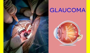 बढ़ी स्वास्थ्य सुविधा : जिला चिकित्सालय में निःशुल्क होगी ग्लूकोमा (काला मोतिया) की सर्जरी, नहीं जाना पड़ेगा बड़े शहर