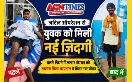 जयपुर-उदयपुर तक नहीं मिली राहत, रतलाम जिला अस्पताल ने जटिल सर्जरी से युवक को फिर पैरों पर खड़ा किया
