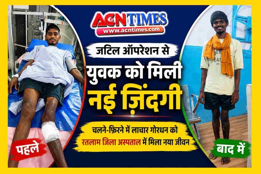 जयपुर-उदयपुर तक नहीं मिली राहत, रतलाम जिला अस्पताल ने जटिल सर्जरी से युवक को फिर पैरों पर खड़ा किया